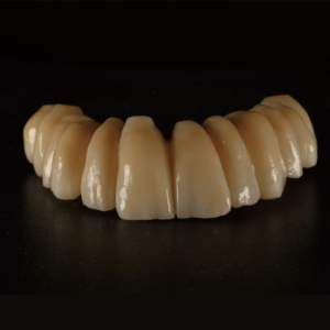 VITA shade zirconia